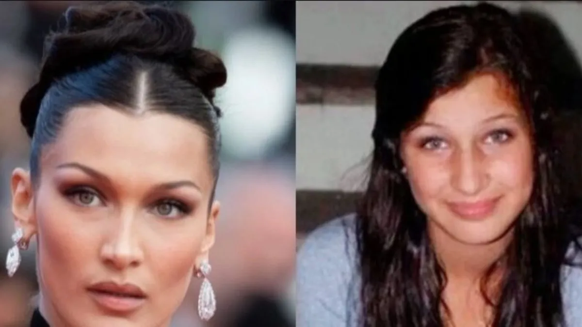 Şöhret ve servet ünlüleri bakın nasıl değiştirmiş! Ünlülerin öncesi ve sonrası fotoğraflarına şok olacaksınız!